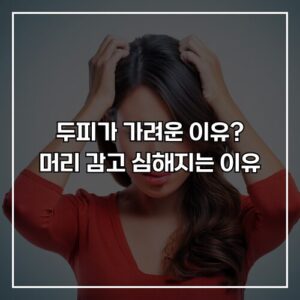 두피가 가려운 이유? 머리 감고 더 심해지는 이유와 해결법