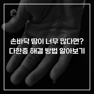 손바닥 땀이 너무 많다면? 다한증 해결 방법 알아보기