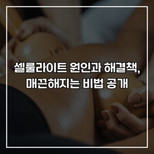 셀룰라이트 원인과 해결책, 허벅지 매끈해지는 비법 공개